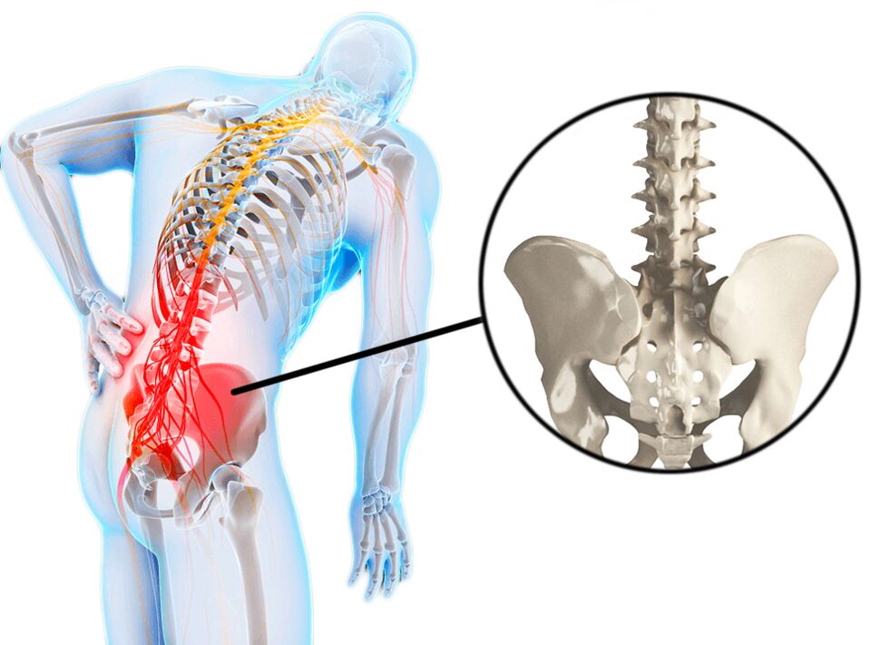 Spinal conditions are a common cause of lower back pain