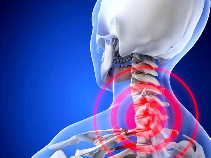 Inflamed cervical region
