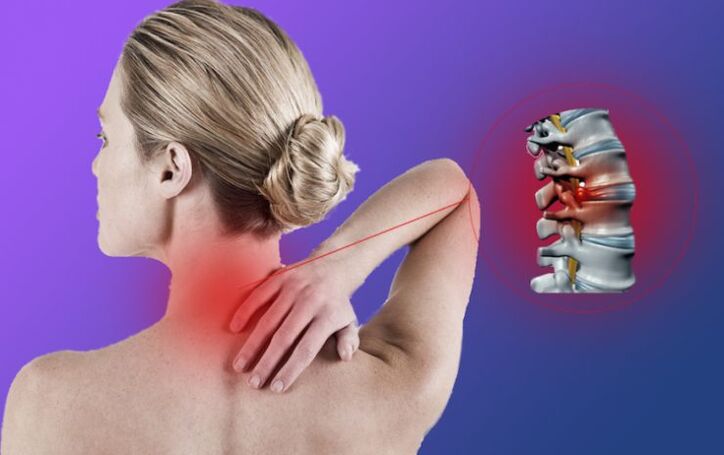 Inflammation of the spine with cervical osteochondosis