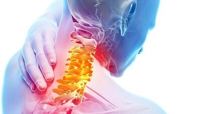 Causes of cervical osteochondosis