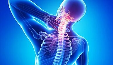 Complications of osteochondosis of the cervical column