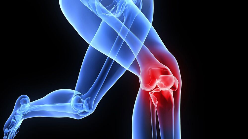 knee problems due to osteoarthritis