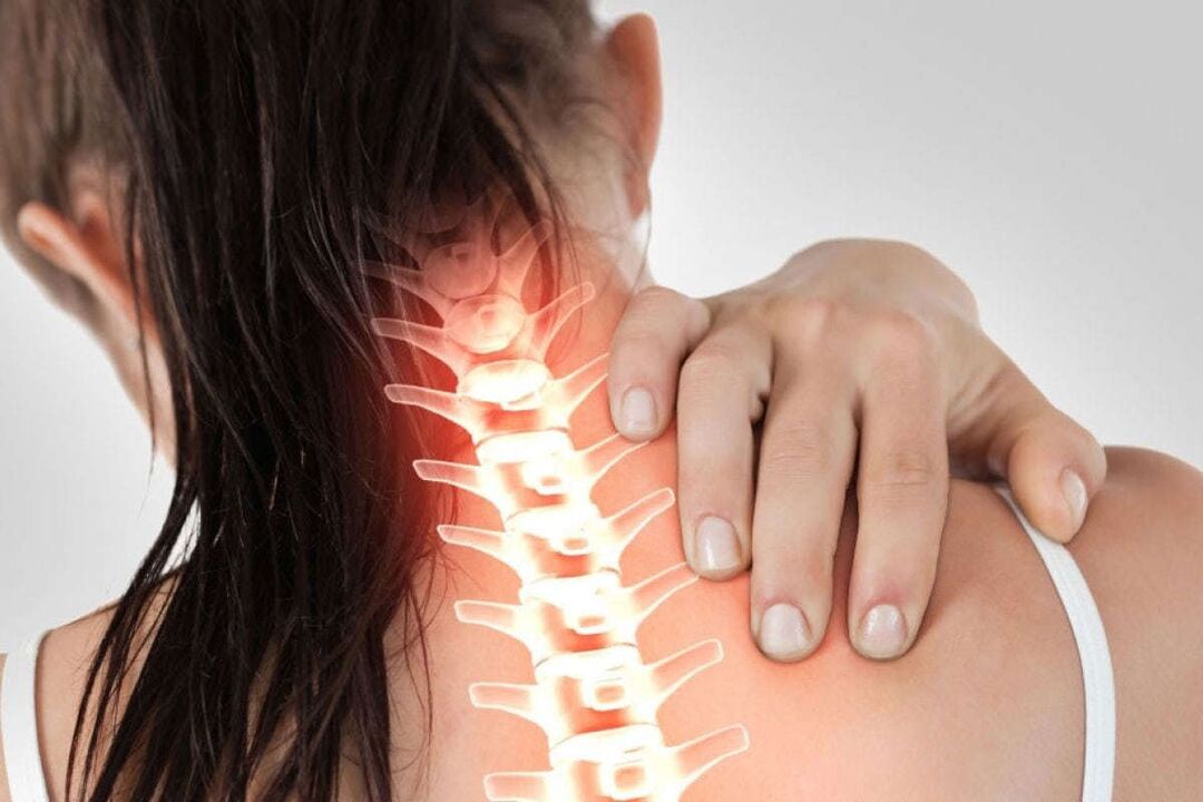 Manifestations of cervical osteochondosis