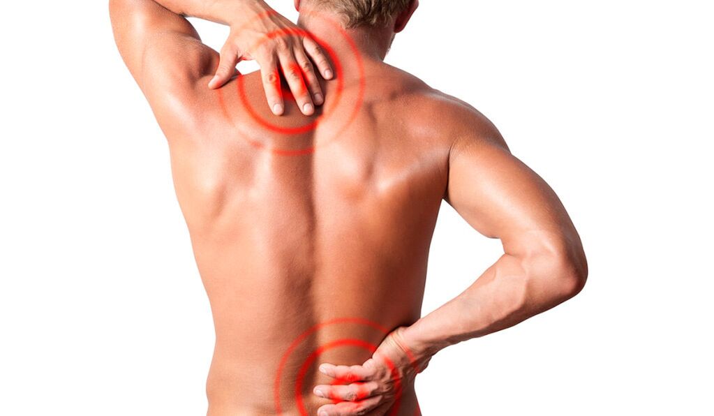 Sciatica can cause back pain in the lower back